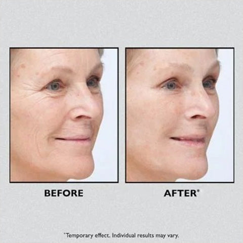 🎁Today 49% OFF🎁Temporary Face And Eye Tightener